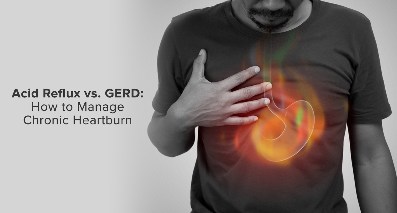 Acid Reflux vs. GERD: How to Manage Chronic Heartburn